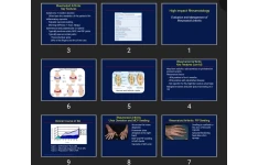 پاورپوینت Evaluation and Management of Rheumatoid Arthritis