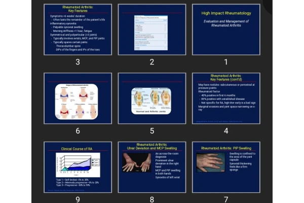 پاورپوینت Evaluation and Management of Rheumatoid Arthritis