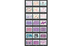 پاورپوینت hematopoietic & Endocrine
