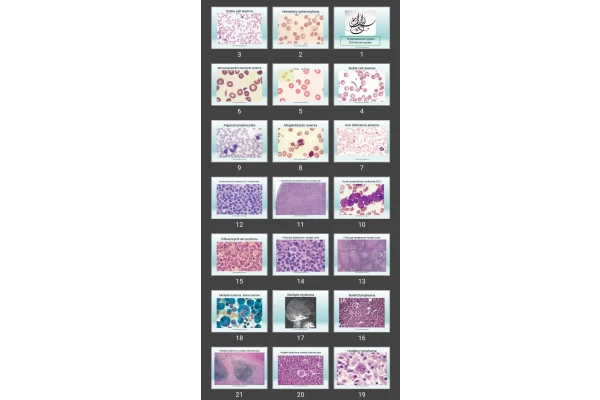 پاورپوینت hematopoietic & Endocrine