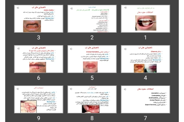 پاورپوینت اختلالات حفره دهان