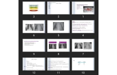 پاورپوینت Neonatal Respiratory Distress