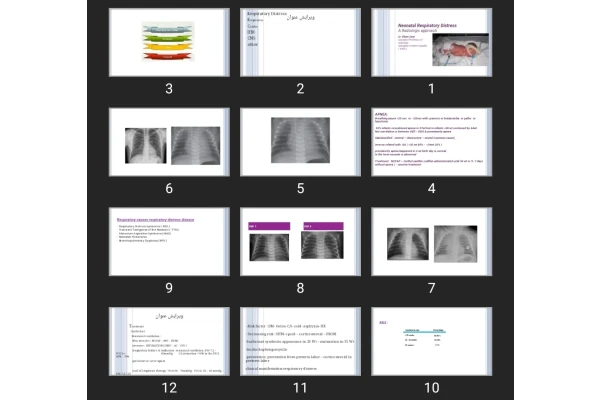 پاورپوینت Neonatal Respiratory Distress
