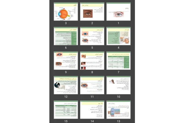 پاورپوینت بیماری های شایع چشم