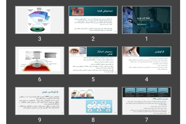 پاورپوینت اختلالات قرنیه