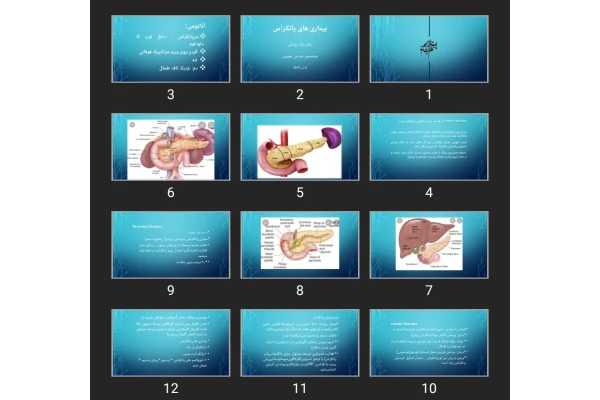 پاورپوینت بیماری های پانکراس