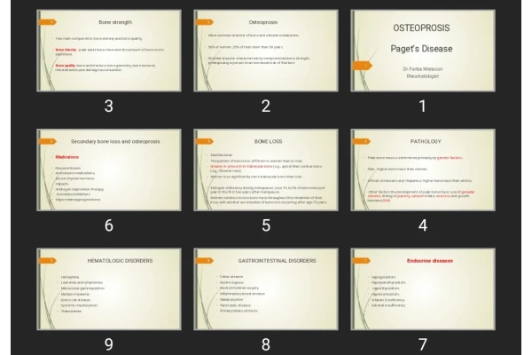 پاورپوینت استئوپروز OSTEOPROSIS Paget’s Disease