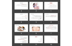 پاورپوینت سیستم تنفسی آسم Asthma