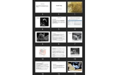 پاورپوینت Prenatal Testing