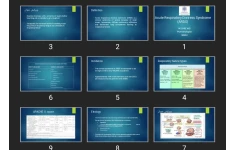 پاورپوینت Acute Respiratory Distress Syndrome (ARDS)