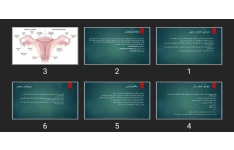 پاورپوینت بارداری خارج رحمی