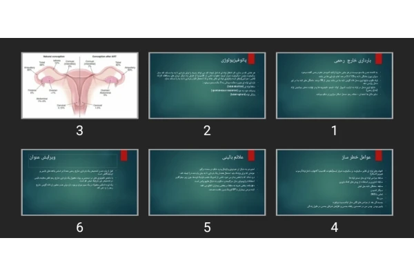 پاورپوینت بارداری خارج رحمی