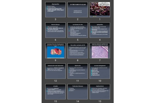 پاورپوینت PATHOLOGY OF male genital tract