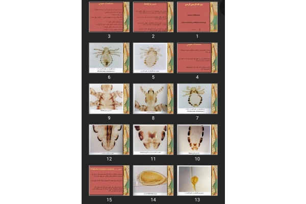 پاورپوینت (Lice) شپش ها