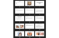 پاورپوینت Abdominal Swelling and Ascites