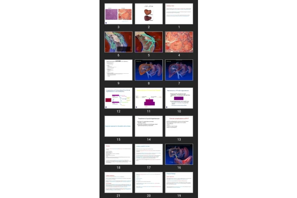 پاورپوینت Cirrhosis Fliver