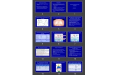 پاورپوینت Clinical Aspects of HIV Disease