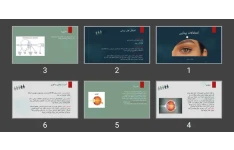 پاورپوینت اختلالات بینایی