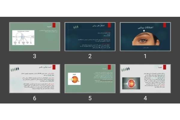 پاورپوینت اختلالات بینایی