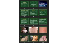 پاورپوینت Rubella (German Measles)