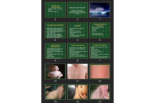 پاورپوینت Rubella (German Measles)
