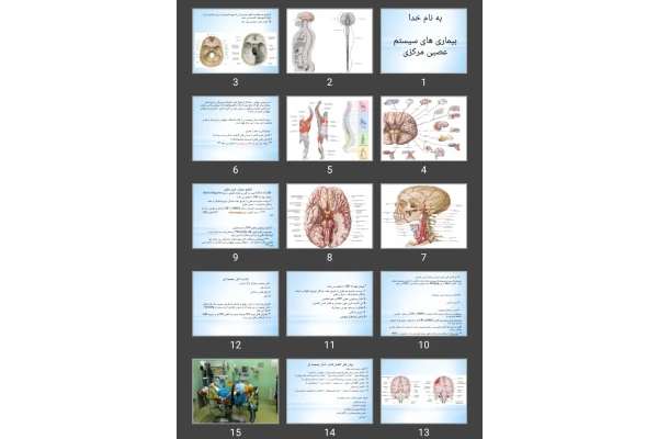 پاورپوینت بیماری های سیستم عصبی مرکزی