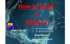 تفسیر CT اسکن مغز 🔬 نسخه کامل ✅