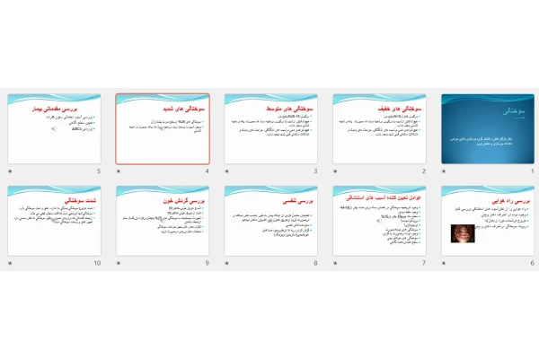 پاورپوینت سوختگی