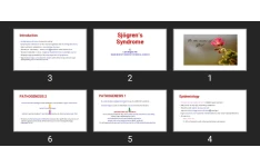 پاورپوینت Sjögren’s Syndrome