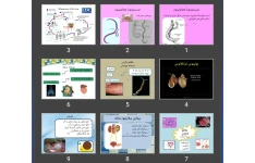 پاورپوینت شیستوزوما هماتوبیوم