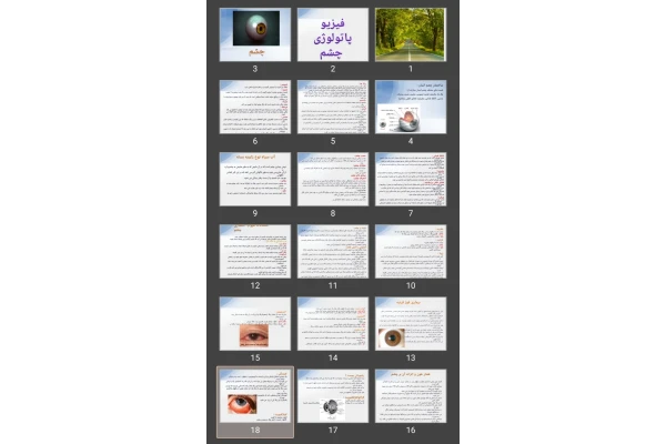 پاورپوینت فیزیو پاتولوژی چشم