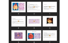 پاورپوینت main lesions of male genital tractVOICE2