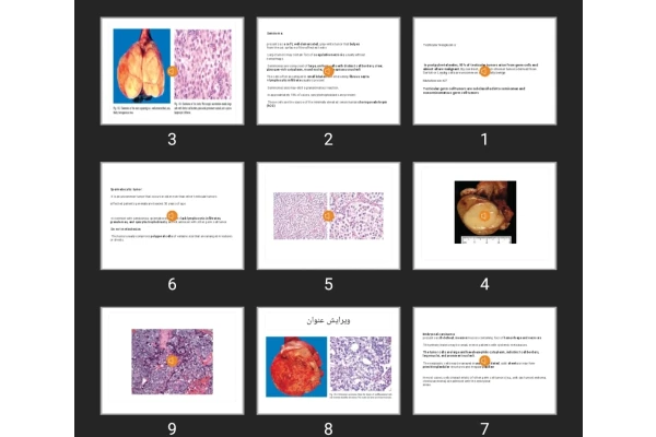 پاورپوینت main lesions of male genital tractVOICE2