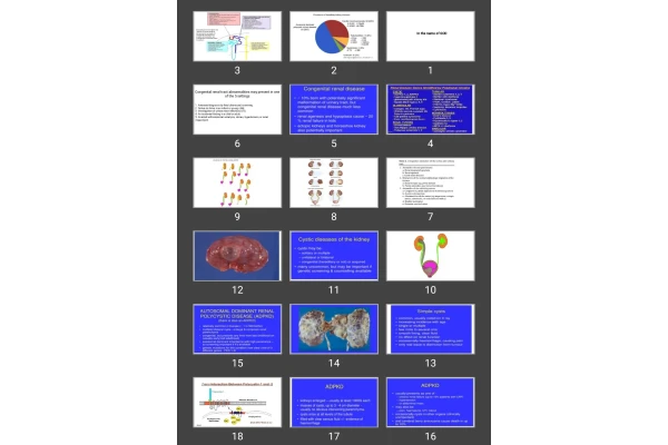 پاورپوینت hereditary renal diseases