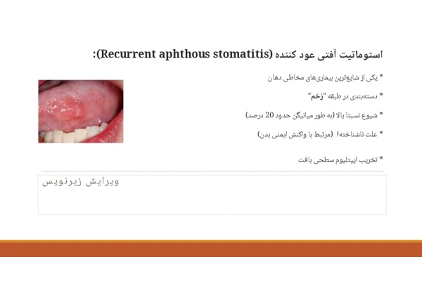 پاورپوینت زخم‌های راجعه آفت