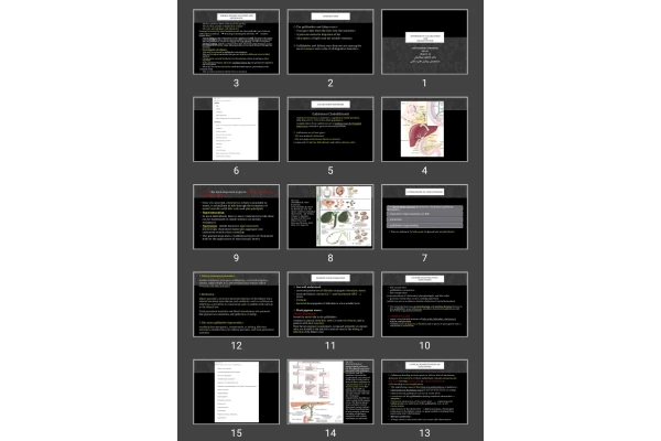 پاورپوینت Disorders of gallbladder and  biliary system